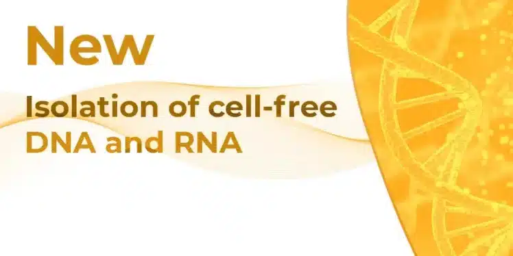 isolation-of-cell-free-dna-and-rna_11_1-2-1.webp isolation of cell free dna and rna 11 1 2 1.webp
